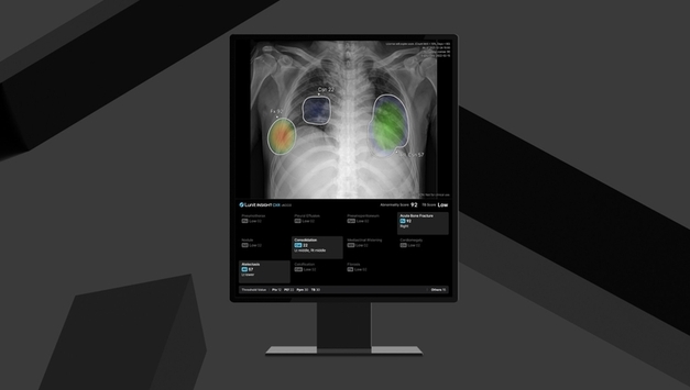 의료 AI업계 지난해 최대 매출 기록…첫 영업이익 달성 상장사 등장